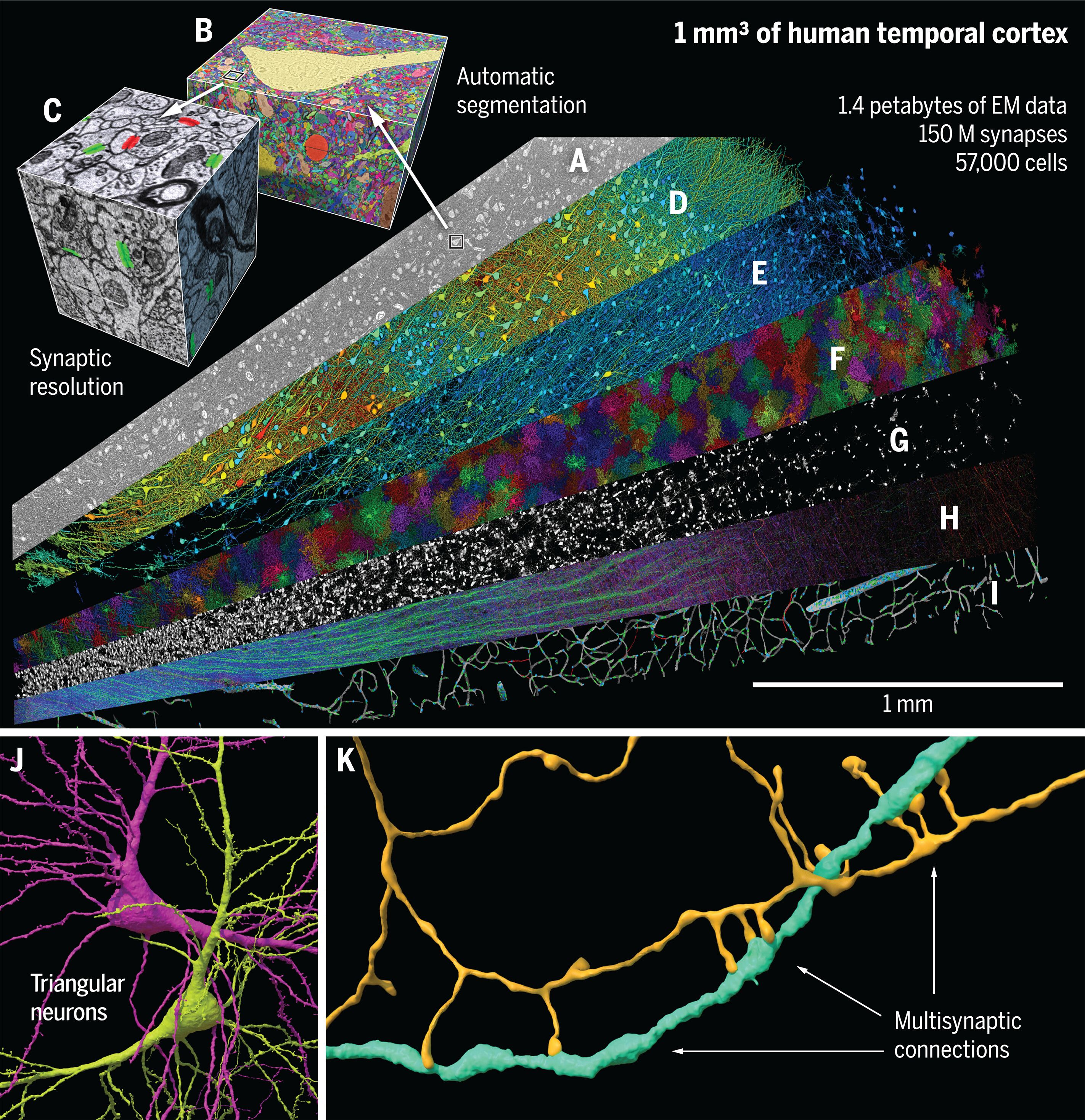 Цілий «космос»: у зразку людського мозку виявили тисячі клітин і мільйони нейронів